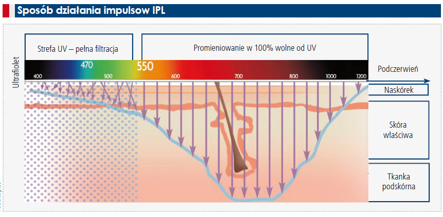 IPL –